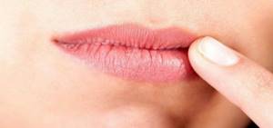 Как подсказывает тело, каких витаминов не хватает организму, Трещины в уголках рта